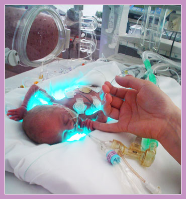 Photo of adult little finger being grabbed by a premature baby in an incubator.