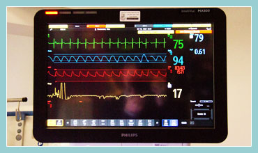 Photo of a Vital Signs Monitor